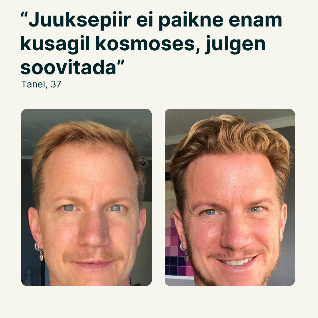 Juuksekasvu seerum meestele