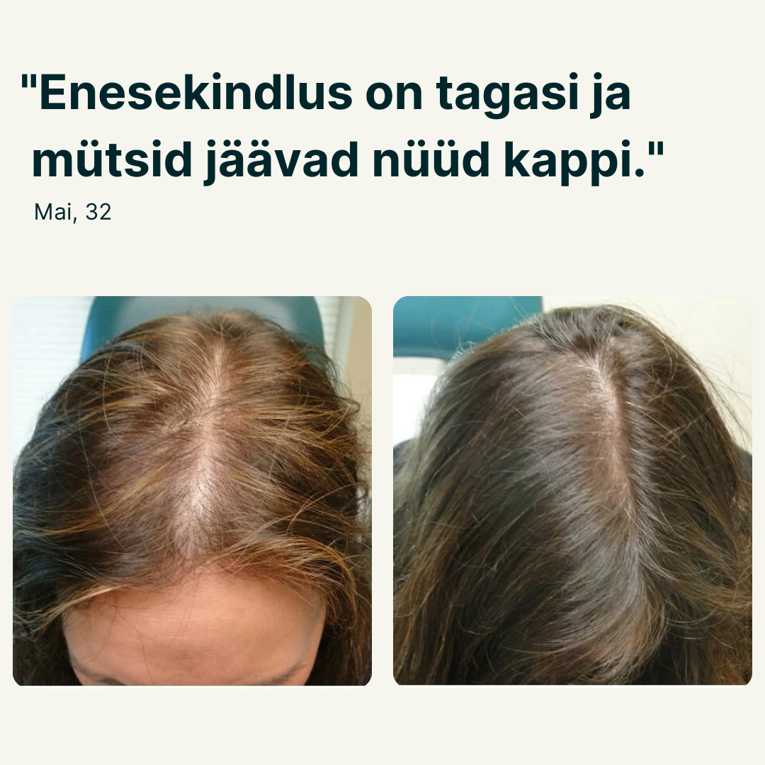 juuksekasvu seerum